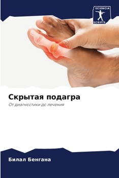 Paperback Скрытая подагра [Russian] Book