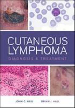 Hardcover Cutaneous Lymphoma Diagnosis and Treatment Book
