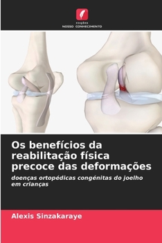 Paperback Os benefícios da reabilitação física precoce das deformações [Portuguese] Book