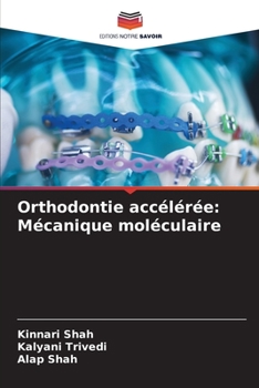 Paperback Orthodontie accélérée: Mécanique moléculaire [French] Book