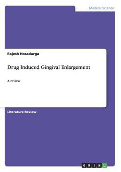 Paperback Drug Induced Gingival Enlargement: A review Book
