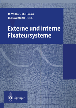 Paperback Externe Und Interne Fixateursysteme [German] Book