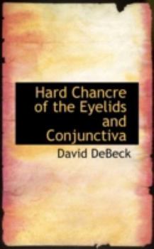 Paperback Hard Chancre of the Eyelids and Conjunctiva Book