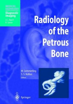 Hardcover Radiology of the Petrous Bone Book