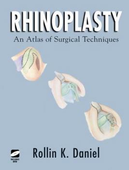 Hardcover Rhinoplasty: An Atlas of Surgical Techniques Book