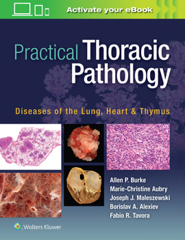 Hardcover Practical Thoracic Pathology: Diseases of the Lung, Heart, and Thymus Book