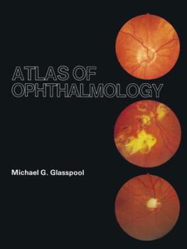 Hardcover Atlas of Ophthalmology Book