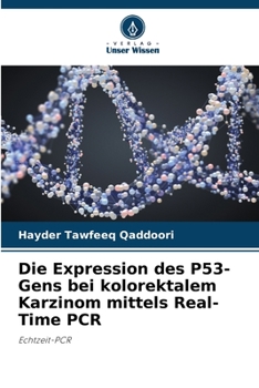 Paperback Die Expression des P53-Gens bei kolorektalem Karzinom mittels Real-Time PCR [German] Book
