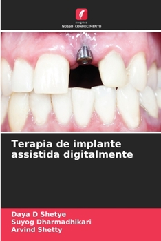 Paperback Terapia de implante assistida digitalmente [Portuguese] Book