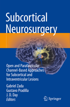 Paperback Subcortical Neurosurgery: Open and Parafascicular Channel-Based Approaches for Subcortical and Intraventricular Lesions Book