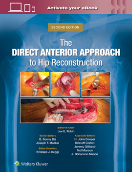 Hardcover The Direct Anterior Approach to Hip Reconstruction Book