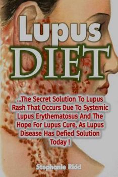 Paperback Lupus Diet: The Secret Solution To Lupus Rash That Occurs Due To Systemic Lupus Book