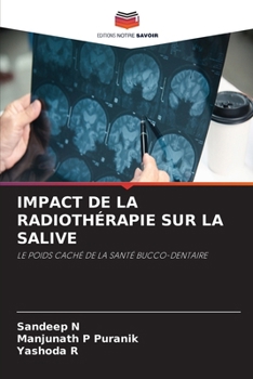 Impact de la Radiothérapie Sur La Salive (French Edition)