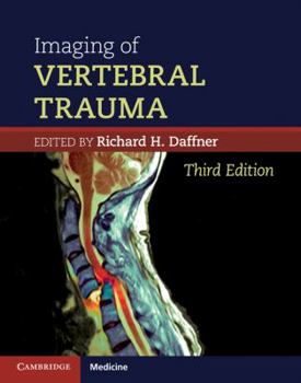 Hardcover Imaging of Vertebral Trauma Book