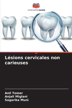 Paperback Lésions cervicales non carieuses [French] Book