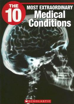 Paperback The 10 Most Extraordinary Medical Conditions Book