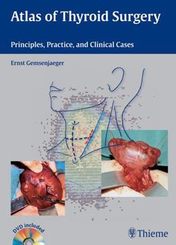 Hardcover Atlas of Thyroid Surgery: Principles, Practice, and Clinical Cases [With DVD] Book