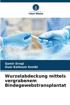 Paperback Wurzelabdeckung mittels vergrabenem Bindegewebstransplantat [German] Book