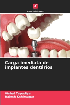 Paperback Carga imediata de implantes dentários [Portuguese] Book