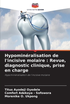 Hypominéralisation de l'incisive molaire : Revue, diagnostic clinique, prise en charge: Hypominéralisation de l'incisive molaire