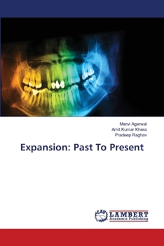 Expansion: Past To Present