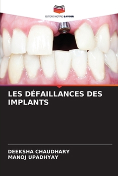 Paperback Les Défaillances Des Implants [French] Book