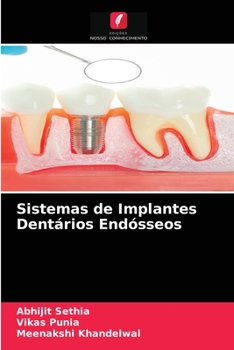 Paperback Sistemas de Implantes Dentários Endósseos [Portuguese] Book