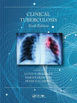 Paperback Clinical Tuberculosis Book