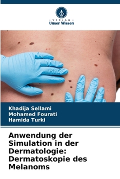 Paperback Anwendung der Simulation in der Dermatologie: Dermatoskopie des Melanoms [German] Book