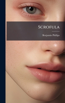 Hardcover Scrofula Book