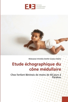 Paperback Etude échographique du cône médullaire [French] Book