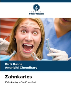 Paperback Zahnkaries [German] Book