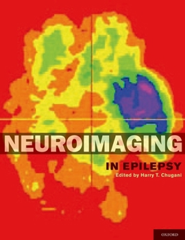 Hardcover Neuroimaging in Epilepsy Book