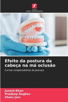 Efeito da postura da cabeça na má oclusão (Portuguese Edition)