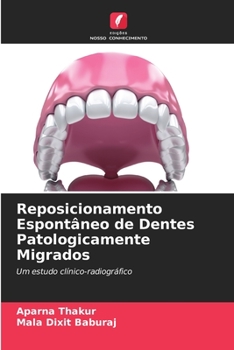Paperback Reposicionamento Espontâneo de Dentes Patologicamente Migrados [Portuguese] Book