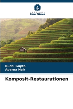 Paperback Komposit-Restaurationen [German] Book