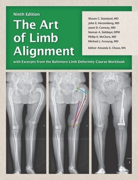 Paperback The Art of Limb Alignment with Excerpts from the Baltimore Limb Deformity Course Workbook Book