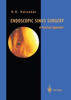Paperback Endoscopic Sinus Surgery: A Practical Approach Book