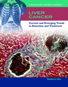 Library Binding Liver Cancer: Current and Emerging Trends in Detection and Treatment Book