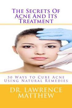 Paperback The Secrets of Acne and Its Treatment: 50 Ways to Cure Acne Using Natural Remedies Book