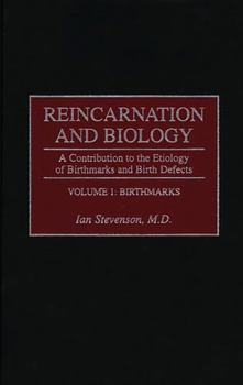 Hardcover Reincarnation and Biology: A Contribution to the Etiology of Birthmarks and Birth Defects Volume 1: Birthmarks Book