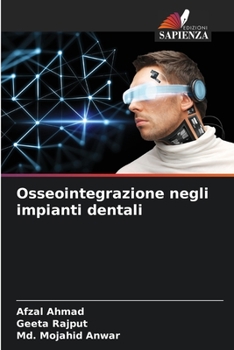 Paperback Osseointegrazione negli impianti dentali [Italian] Book