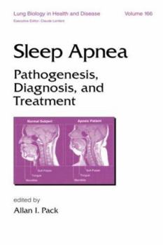 Hardcover Sleep Apnea: Pathogenesis, Diagnosis and Treatment (Lung Biology in Health and Disease) Book