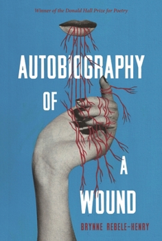 Paperback Autobiography of a Wound: Poems Book