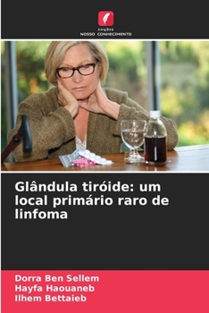 Paperback Glândula tiróide: um local primário raro de linfoma [Portuguese] Book