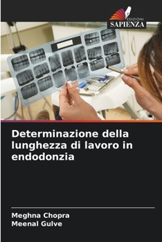 Paperback Determinazione della lunghezza di lavoro in endodonzia [Italian] Book