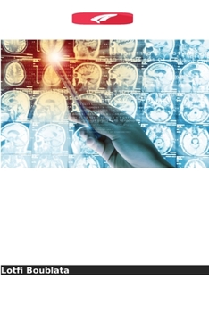 Paperback Craniofaringioma [Portuguese] Book