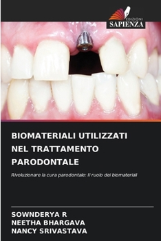 Biomateriali Utilizzati Nel Trattamento Parodontale (Italian Edition)