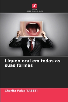 Líquen oral em todas as suas formas