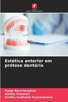 Estética anterior em prótese dentária (Portuguese Edition)